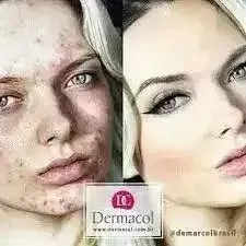 Dermacol Fond de teint couvrance extrême SPF 30 waterproof